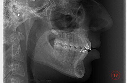Image Alt Text