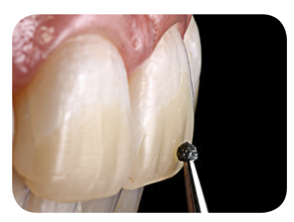 Sof-Lex™ Finishing Strips
