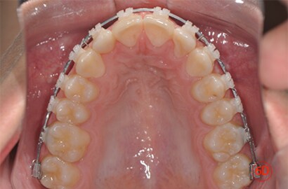 Image Alt Text
