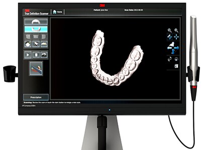 3M™ True Definition Scanner Monitor and Wand