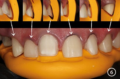 Image Alt Text