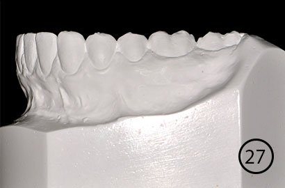 Image Alt Text