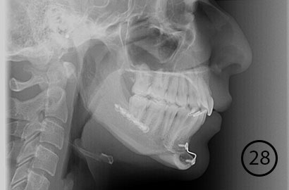 Image Alt Text
