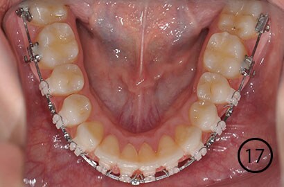 Image Alt Text