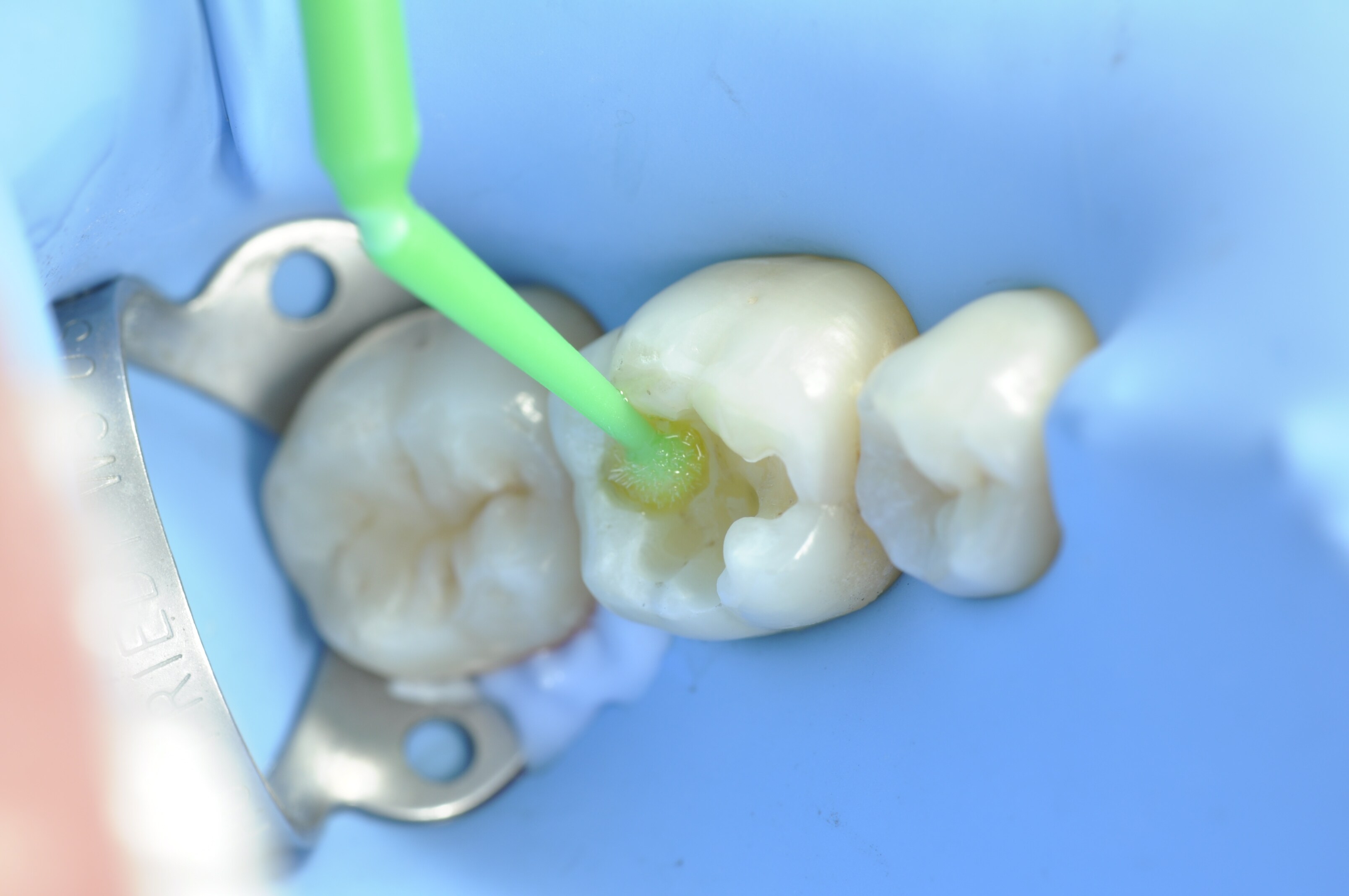 Image Alt Text
