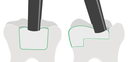 Design Flexibility: Eliminate fasteners for endless possibilities
