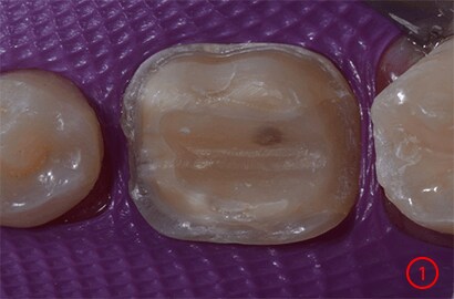 Image Alt Text
