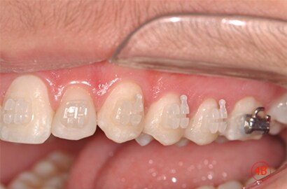Image Alt Text
