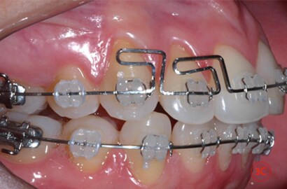 Image Alt Text