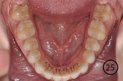 Image Alt Text