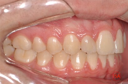 Image Alt Text