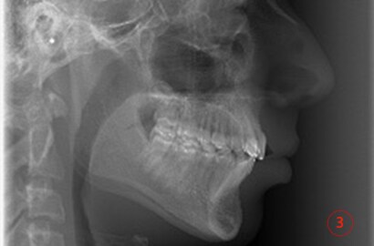 Image Alt Text