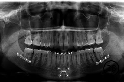 Image Alt Text