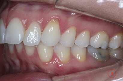 Image Alt Text