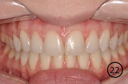 Image Alt Text
