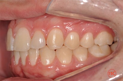 Image Alt Text
