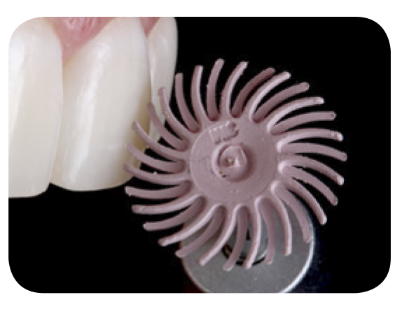 Sof-Lex™ Finishing Strips
