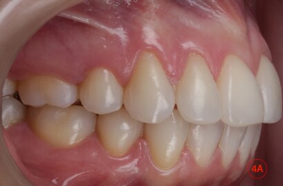 Image Alt Text