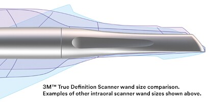 3M™ True Definition Scanner Wand Profile Comparison

