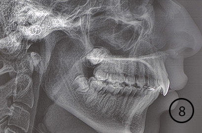 Image Alt Text