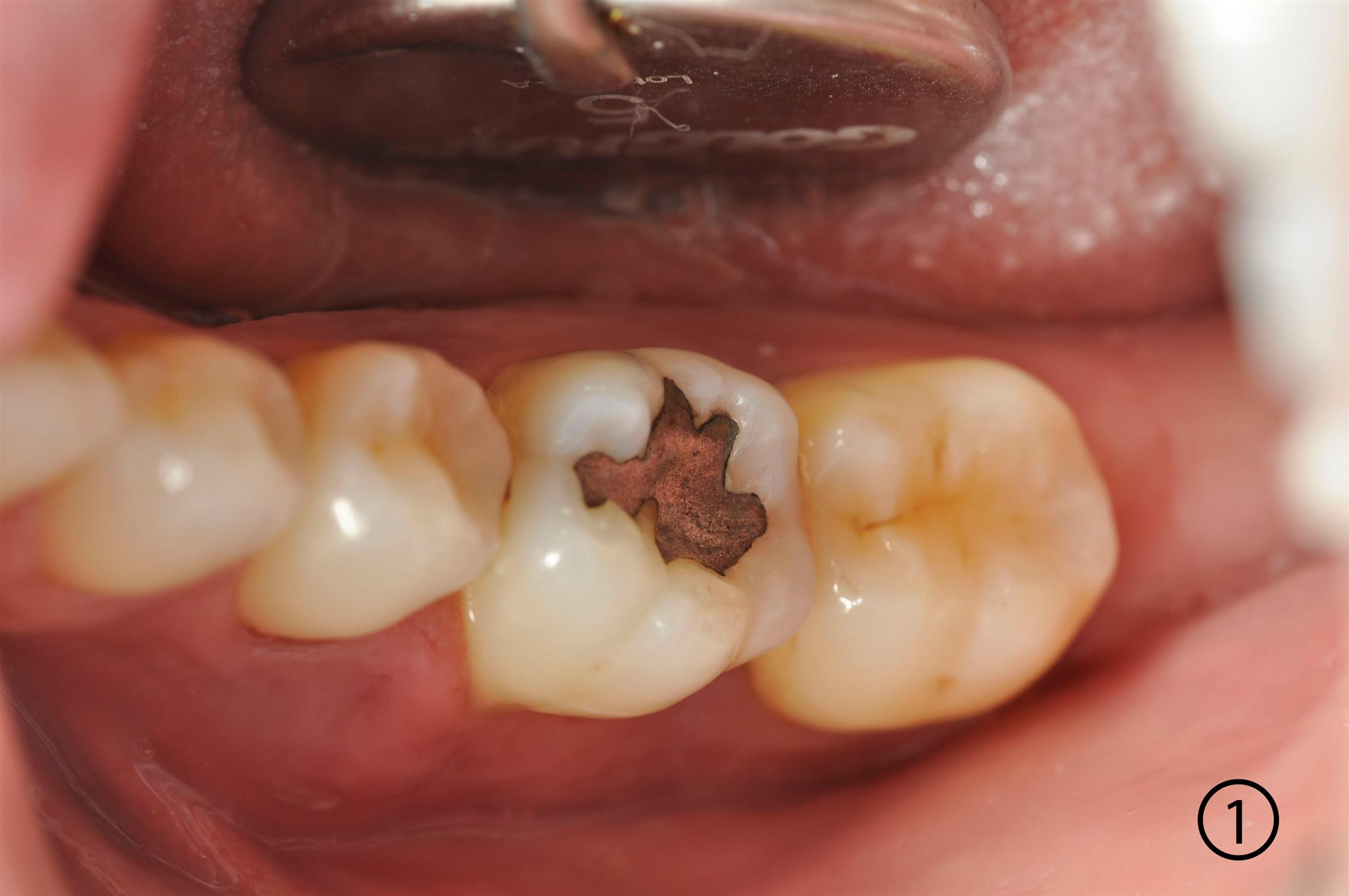 Image Alt Text