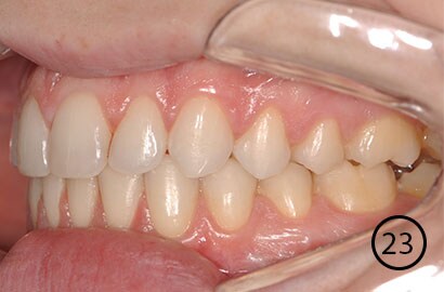 Image Alt Text
