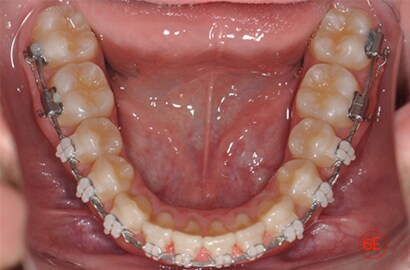 Image Alt Text
