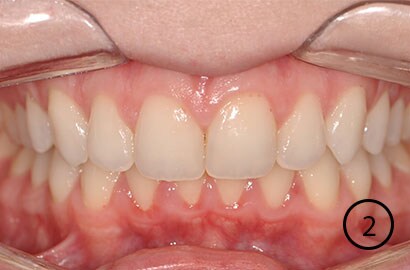 Image Alt Text