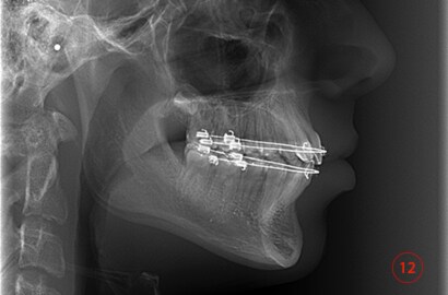 Image Alt Text