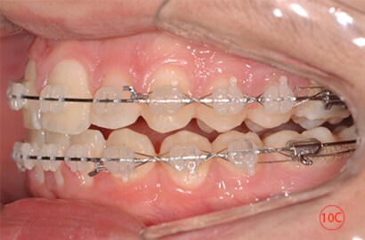 Image Alt Text
