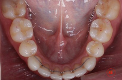 Image Alt Text