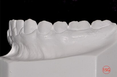 Image Alt Text
