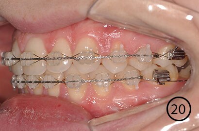Image Alt Text
