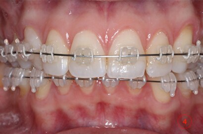Image Alt Text