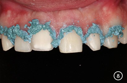 Image Alt Text