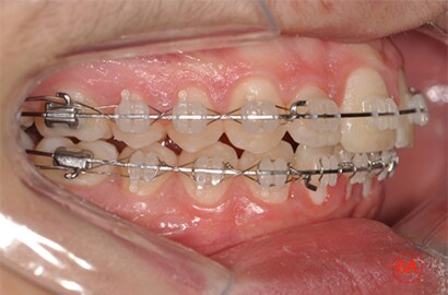Image Alt Text