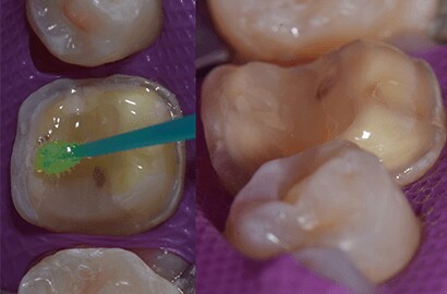 Image Alt Text
