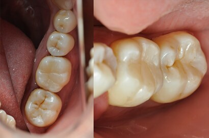 Image Alt Text
