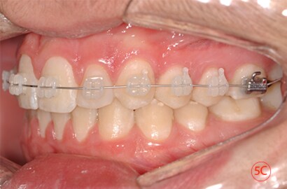 Image Alt Text