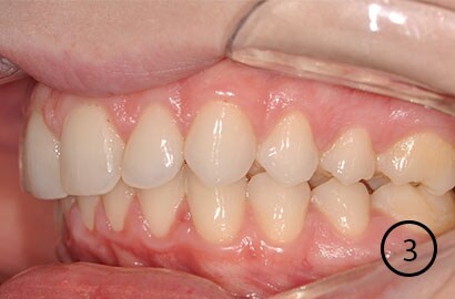 Image Alt Text