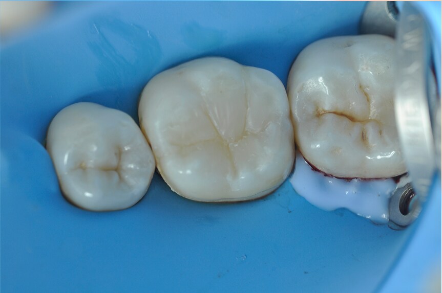 Image Alt Text
