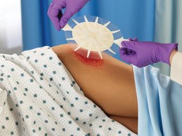 Curativos Para Tratamento De Feridas 3m Hospitalar