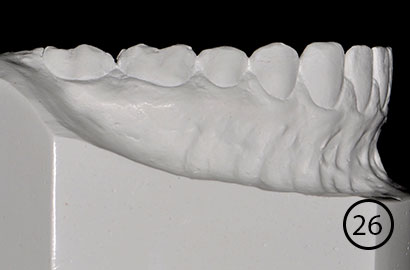 Image Alt Text