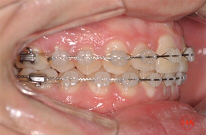 Image Alt Text