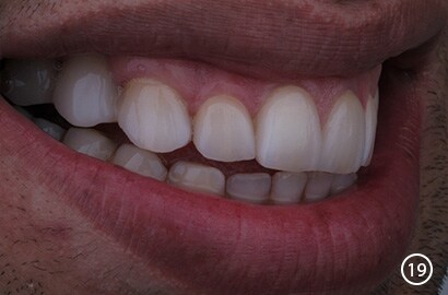 Image Alt Text