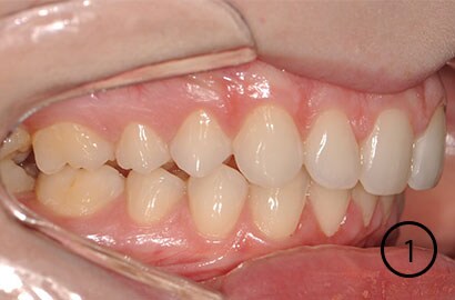 Image Alt Text