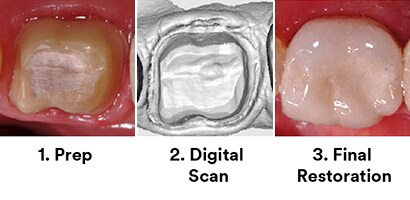 3M™ True Definition Scanner Accurate Scan
