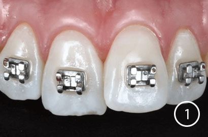 Image Alt Text