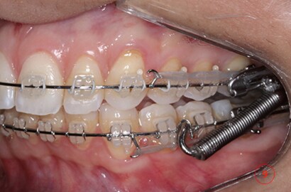 Image Alt Text