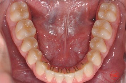 Image Alt Text